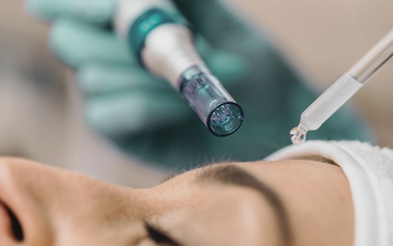 Microneedling x Lemonbottle