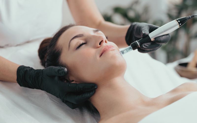 Microneedling